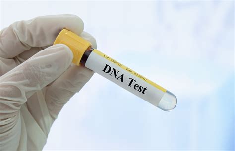 can you get dna test with sealed results from doj|can you collect dna from a suspect.